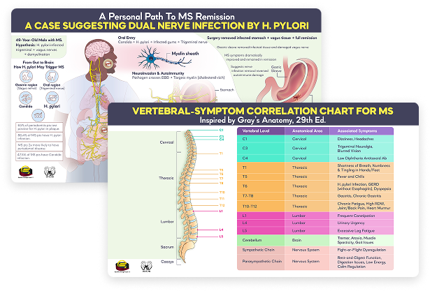 MS Vertebral Symptom Correlation Chart