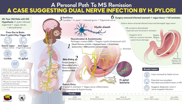 MS Vertebral Symptom Correlation Chart
