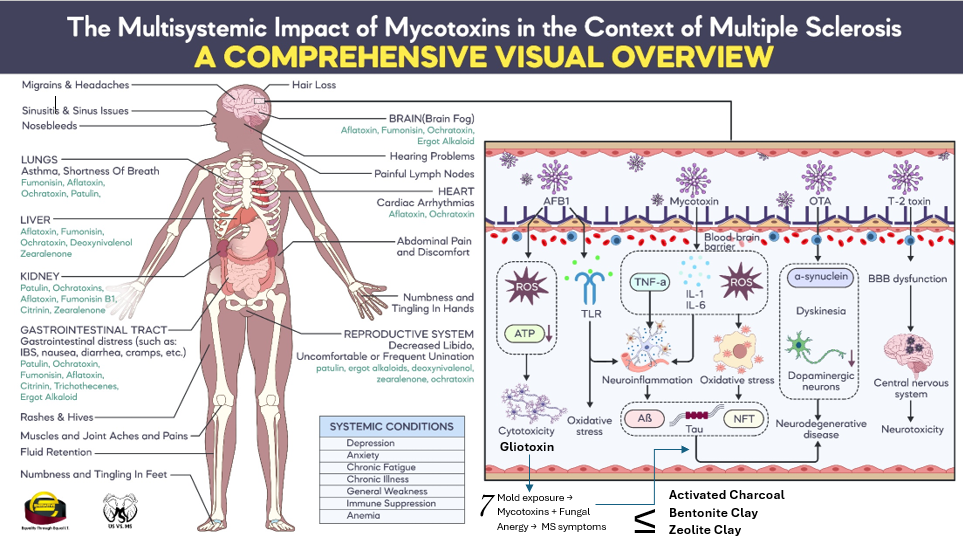 MS Vertebral Symptom Correlation Chart