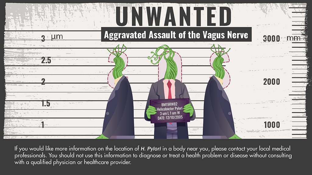 MS Vertebral Symptom Correlation Chart